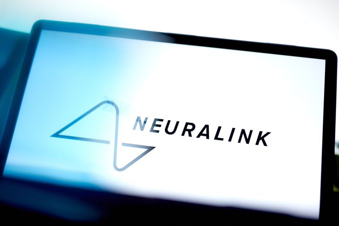 Illustrative photo for: Neuralink brain implant results revealed in new scientific