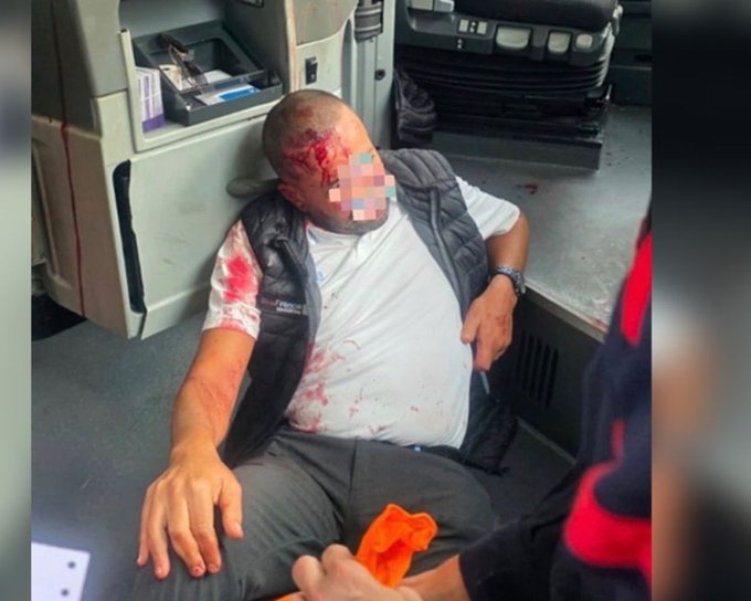 Illustrative photo for: Paris bus driver strike continues after assault; police