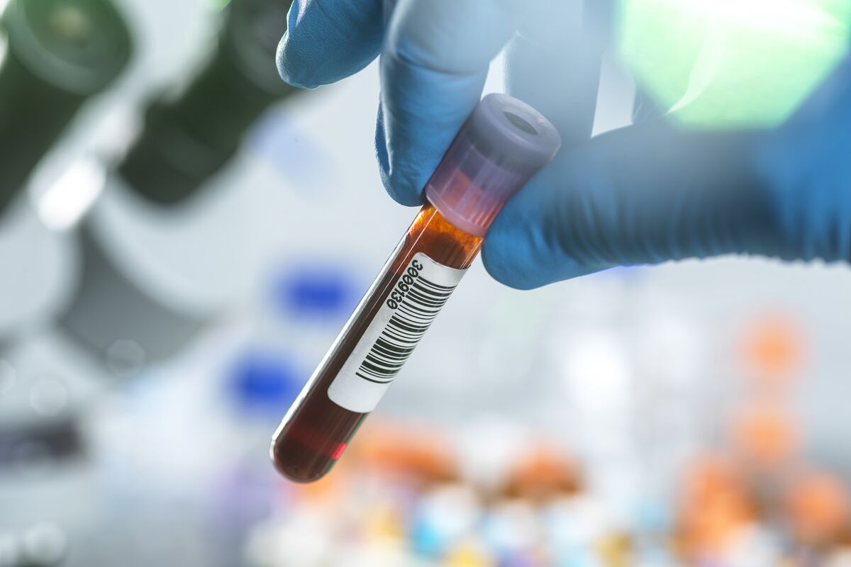 Illustrative photo for: BillionToOne US IPO Raises $273.1 Million Amid Government