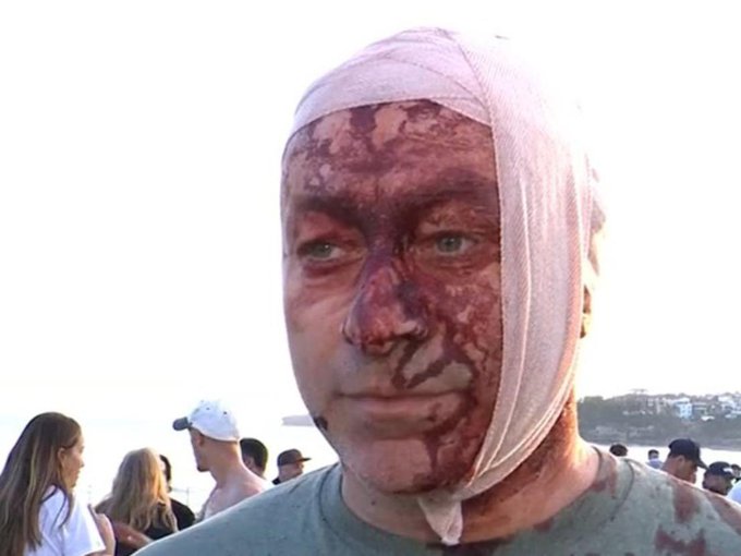 Illustrative photo for: Jewish community anti-Semitism Australia: Survivor Shocked