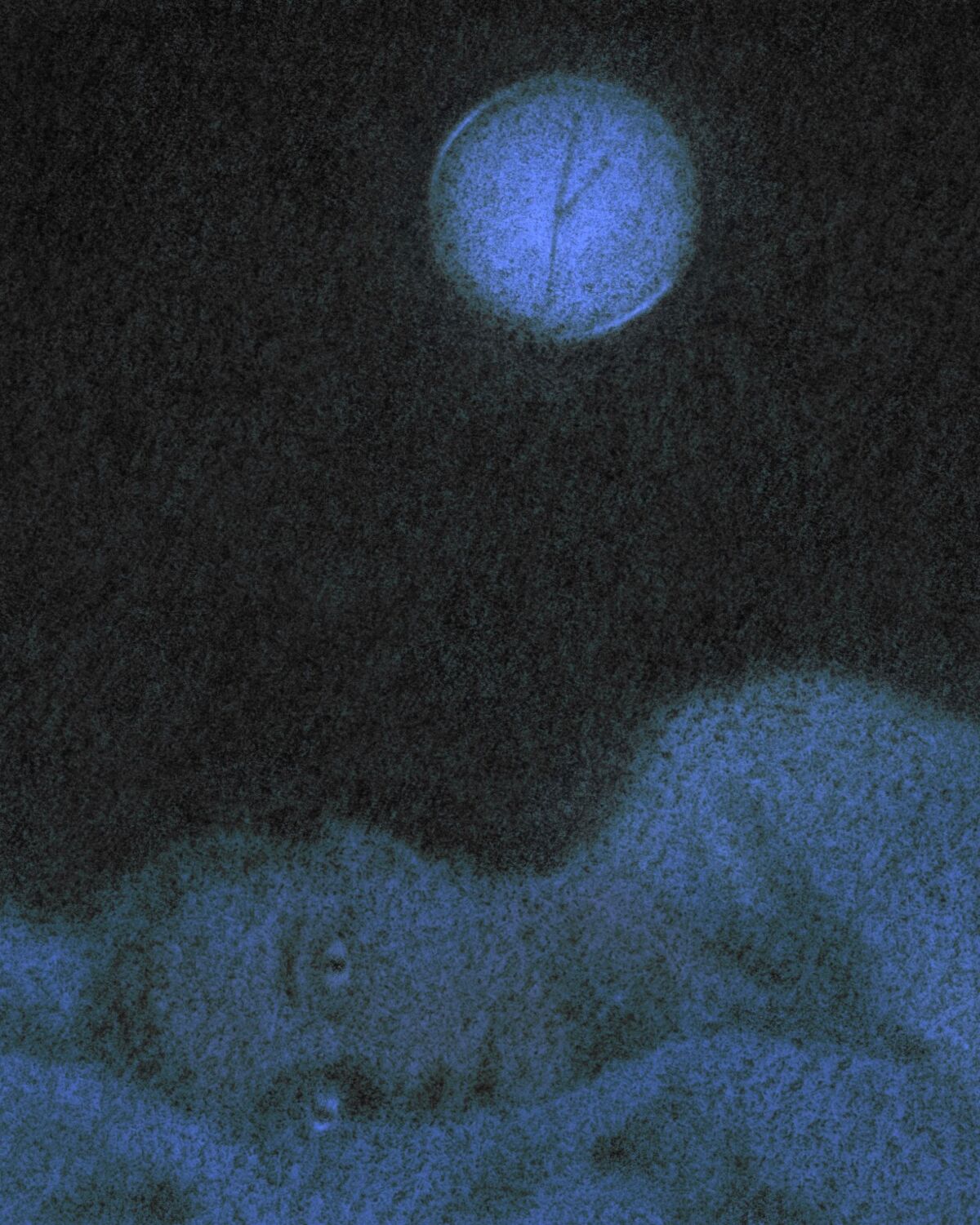 Illustrative photo for: Effects of chronic sleep deprivation: Experts reveal health