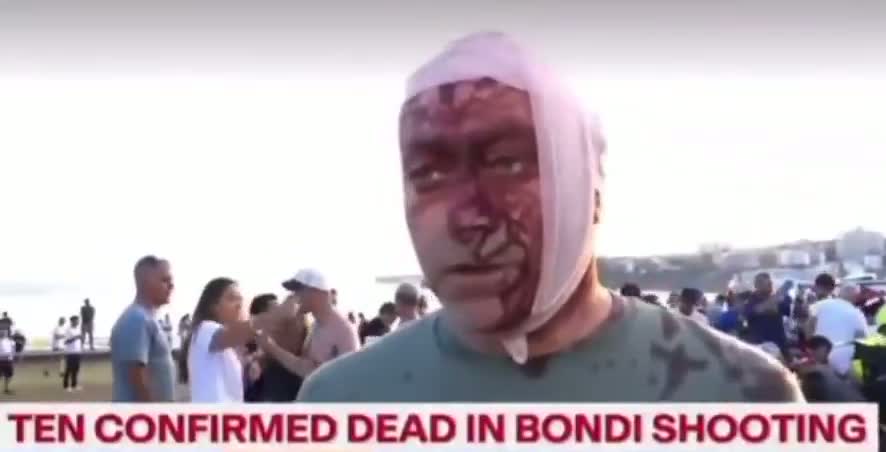 Illustrative photo for: Eyewitness Account of Islamist Attack at Bondi Beach