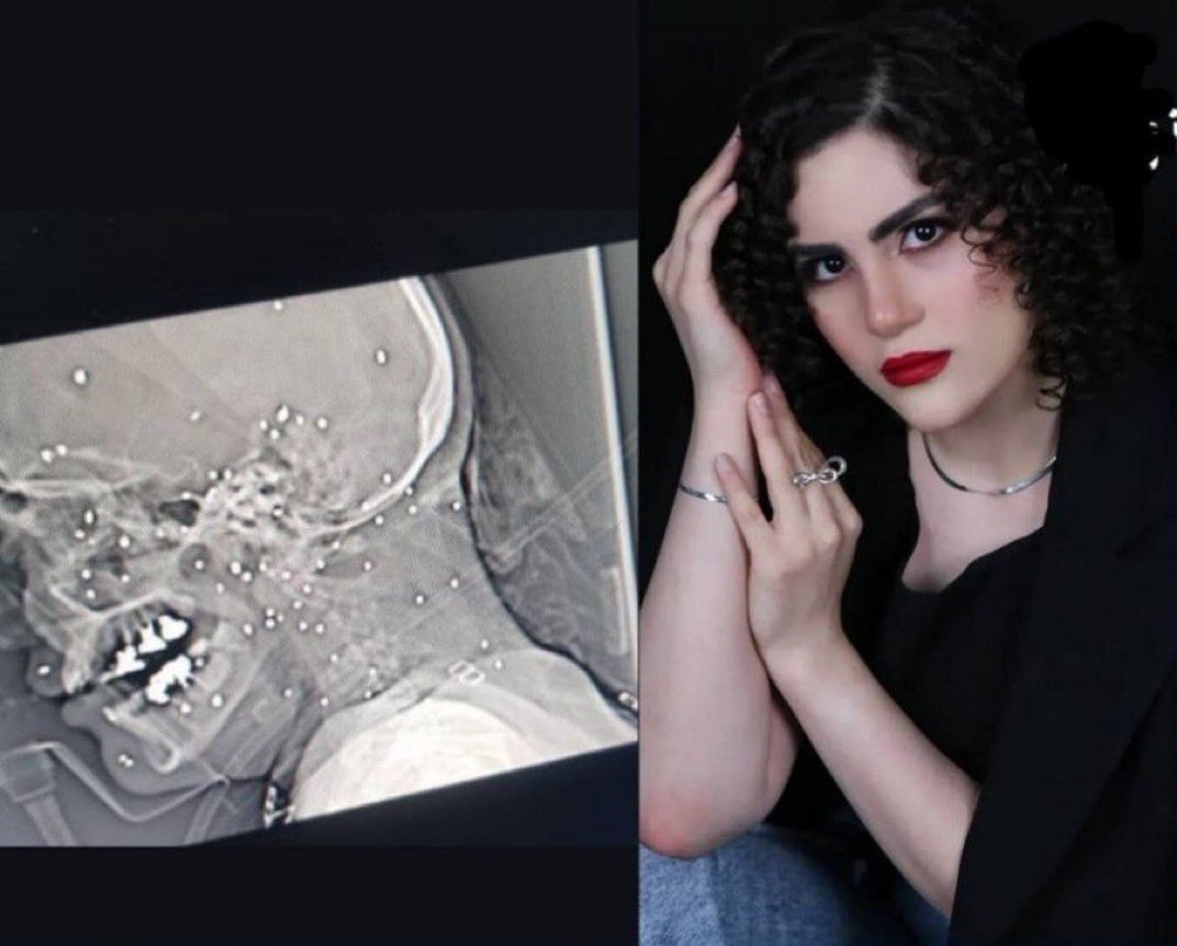 Illustrative photo for: Iranian protester Saghar Etemadi dies at 22 after face