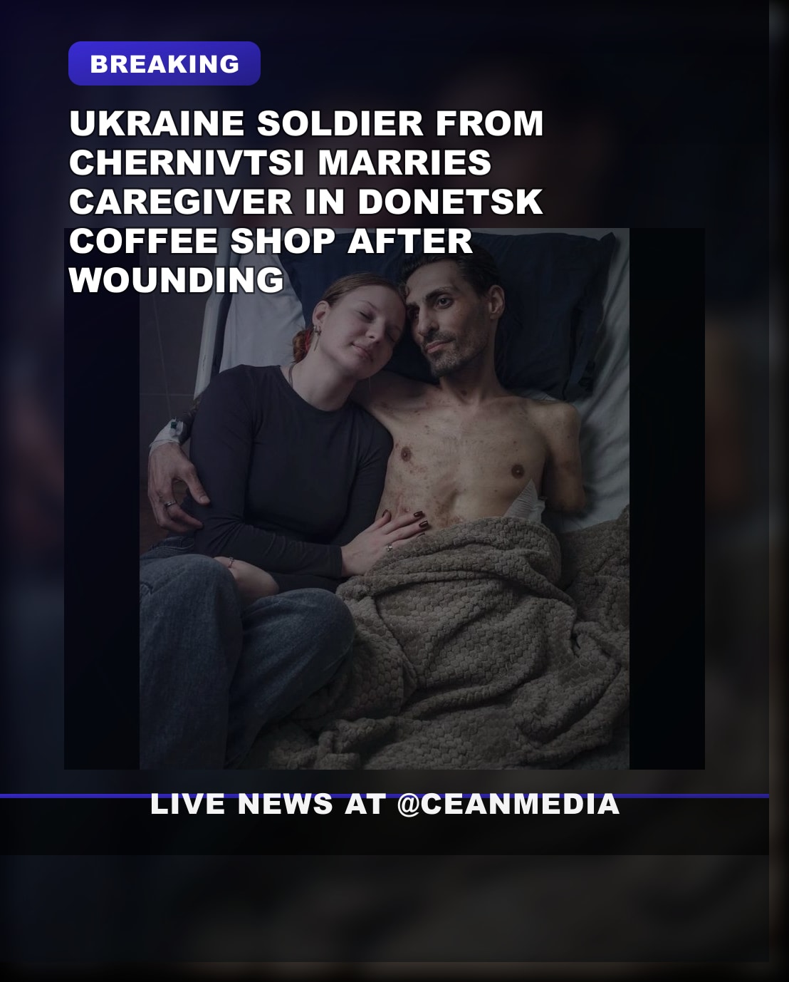 Illustrative photo for: War injury marriage: Ukrainian soldier wounded in battle