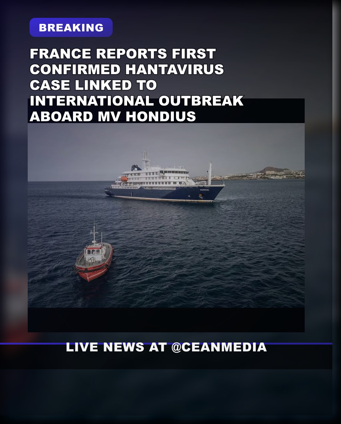 Illustrative photo for: Hantavirus outbreak linked case France: first confirmed