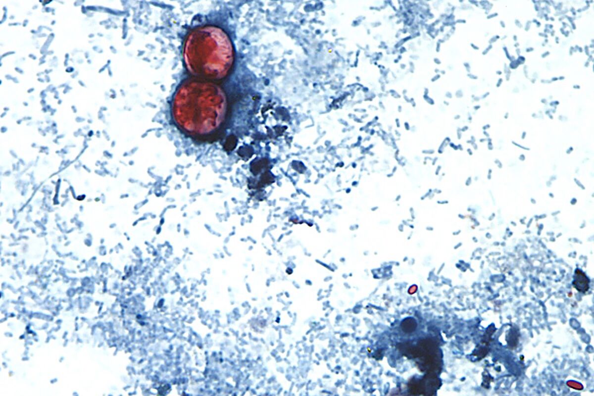 Illustrative photo for: Food safety outbreak source identification: not a single US